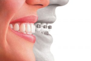 Ortodoncia-Tratamientos