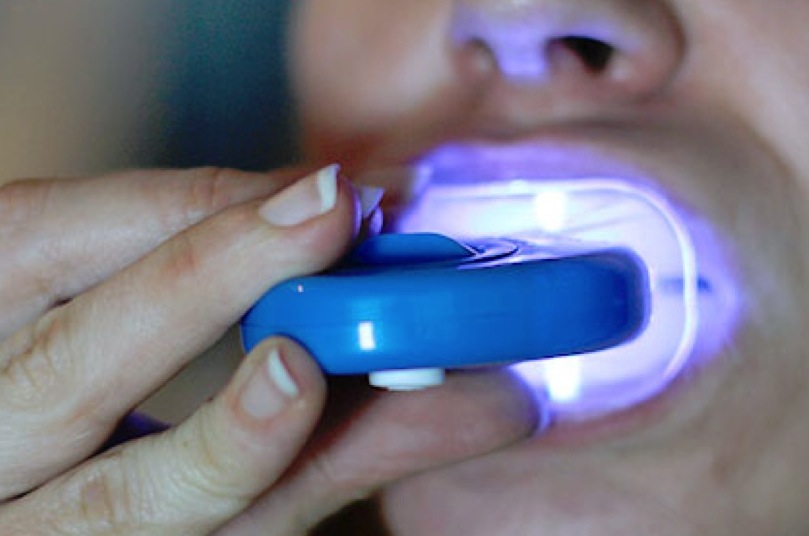 BlnqueamientoDental-Led